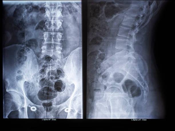 ALL X-RAY